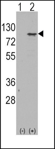 Anti-EME1 (center) antibody produced in rabbit