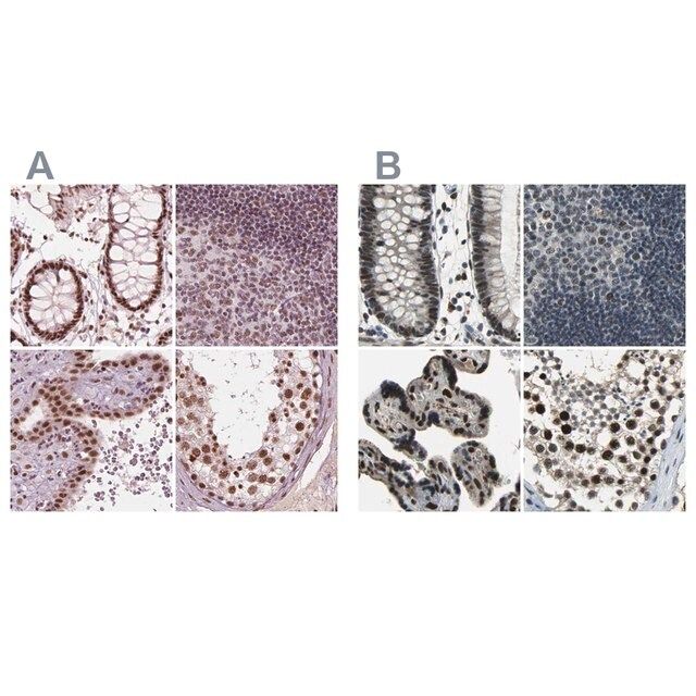 Anti-ELF2 antibody produced in rabbit