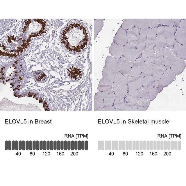 Anti-ELOVL5 antibody produced in rabbit