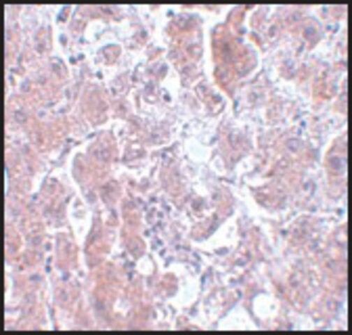 Anti-ELOVL7 antibody produced in rabbit