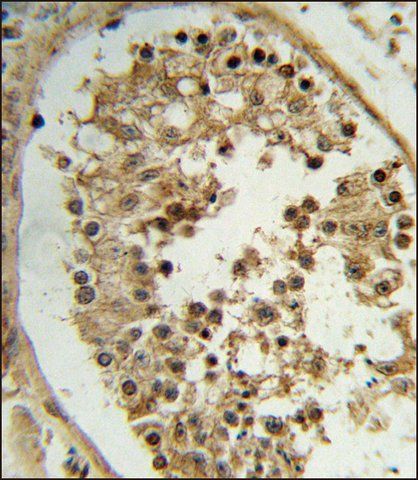 ANTI-ELOVL2 (N-TERM) antibody produced in rabbit