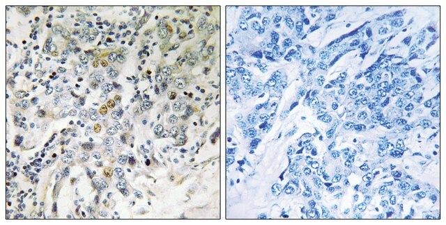 Anti-ELL2 antibody produced in rabbit