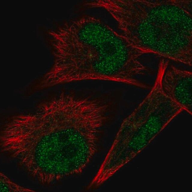 Anti-ELAC1 antibody produced in rabbit