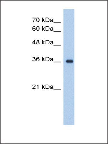 Anti-ELOVL7 antibody produced in rabbit