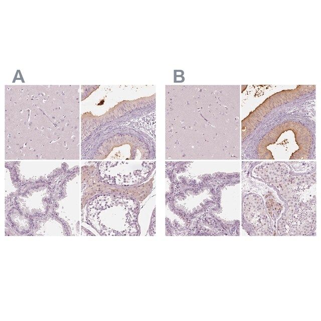 Anti-ELSPBP1 antibody produced in rabbit