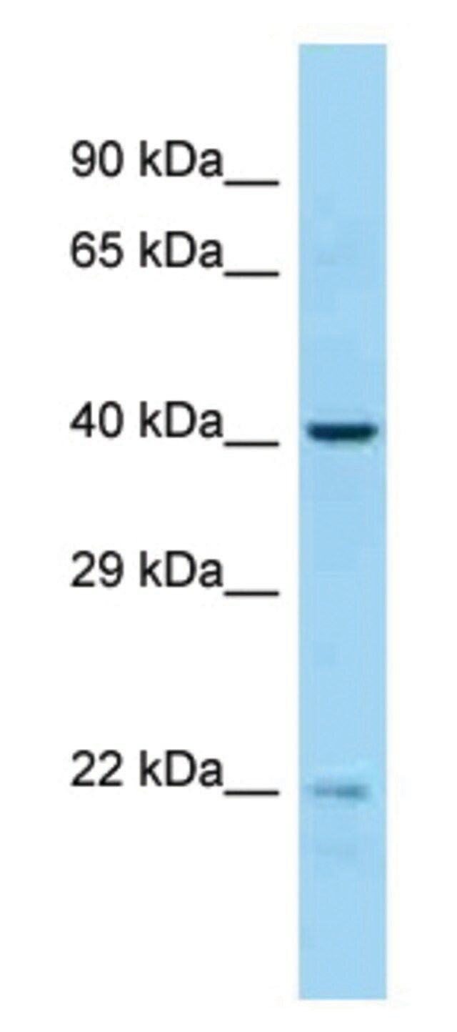 Anti-EME2 antibody produced in rabbit