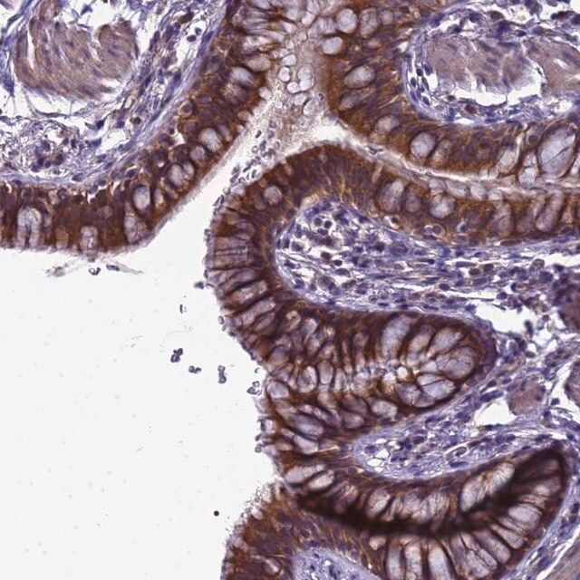 Anti-ELMOD2 antibody produced in rabbit