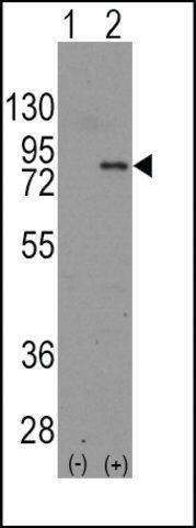 Anti-EME1 (N-term) antibody produced in rabbit