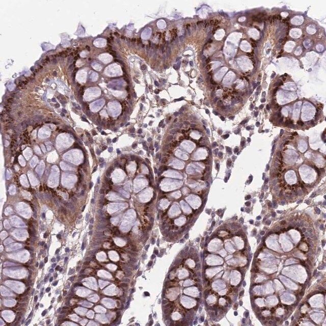 Anti-EMILIN3 antibody produced in rabbit