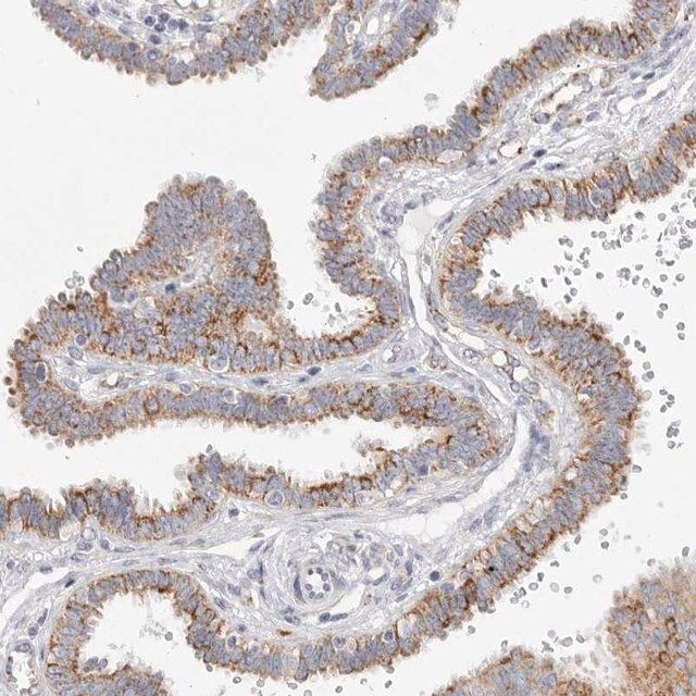 Anti-ELP3 antibody produced in rabbit