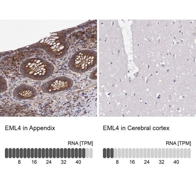 Anti-EML4 antibody produced in rabbit