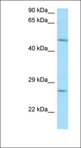 Anti-ENTPD1 antibody produced in rabbit