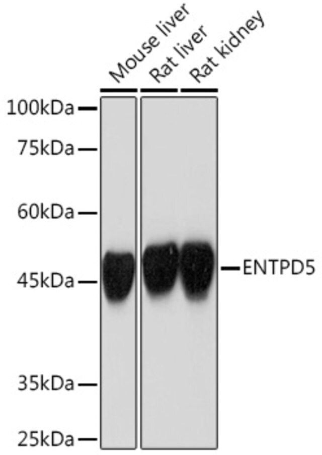 Anti-ENTPD5 antibody produced in rabbit