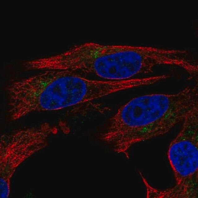 Anti-ENTPD6 antibody produced in rabbit