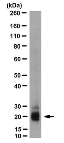 Anti-Eosinophil-Derived Neurotoxin Antibody, clone 6D1.5/A5