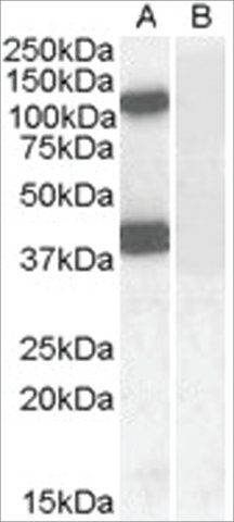 Anti-EPB41L2 /4.1G (AA 593-604) antibody produced in goat