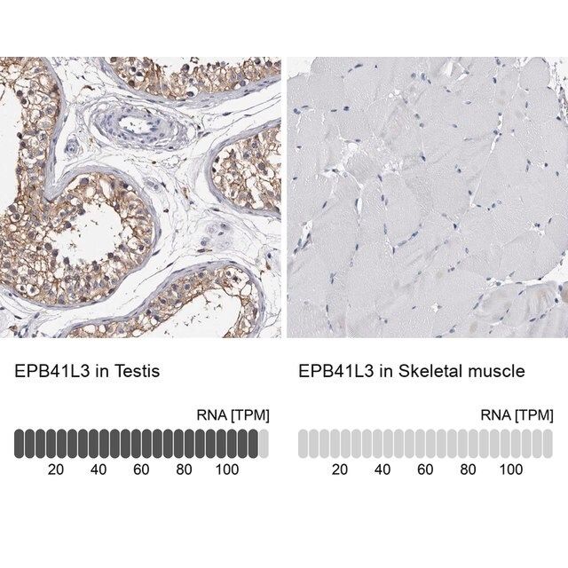 Anti-EPB41L3 antibody produced in rabbit