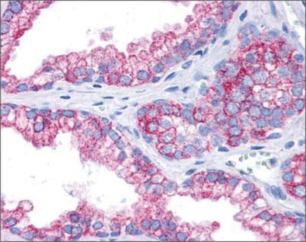 Anti-EPB41L2 antibody produced in rabbit