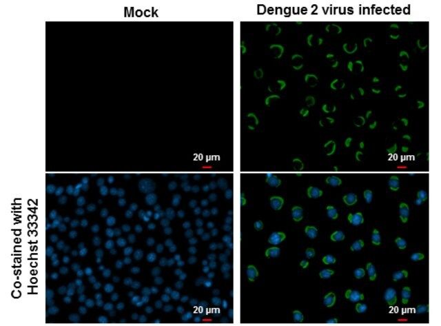 Anti-Envelope protein antibody produced in rabbit