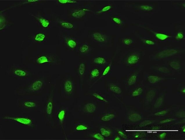 Anti-EPB41L1 antibody produced in rabbit