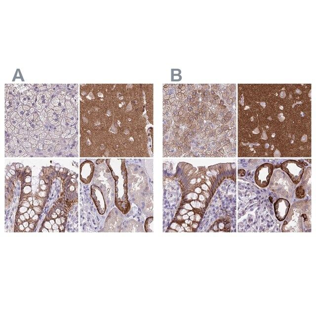 Anti-EPB41L1 antibody produced in rabbit