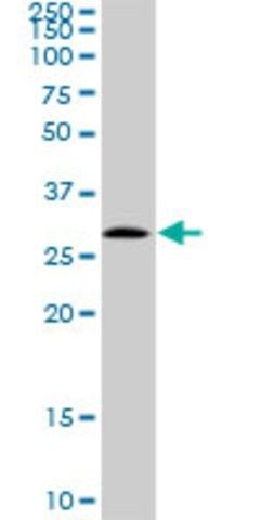 Anti-EPDR1 antibody produced in rabbit