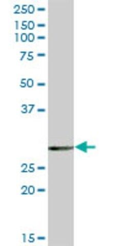 Anti-EPDR1 antibody produced in mouse