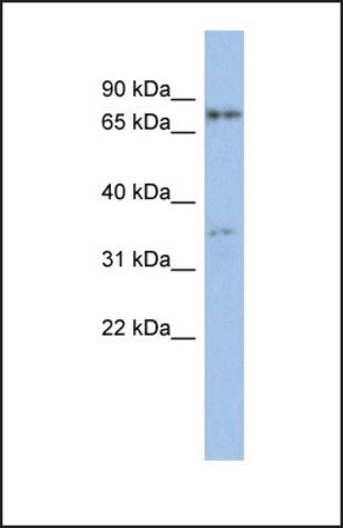 Anti-EOMES antibody produced in rabbit