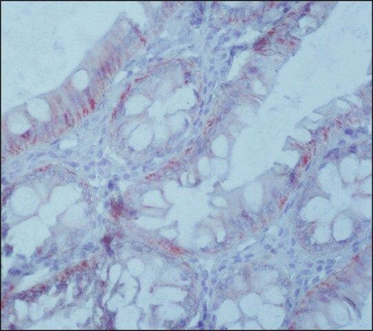 Anti-EpCAM antibody, Mouse monoclonal