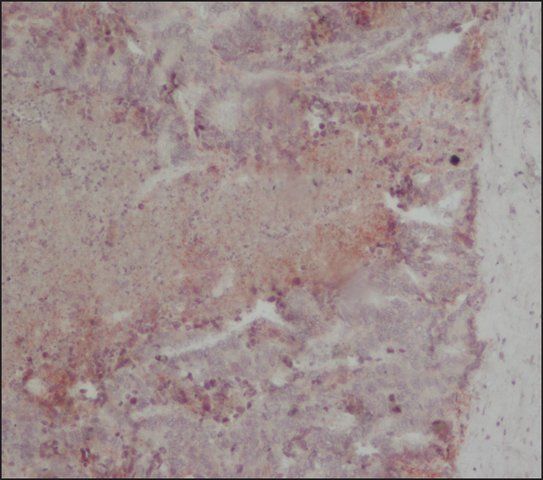 Anti-EpCAM antibody, Mouse monoclonal