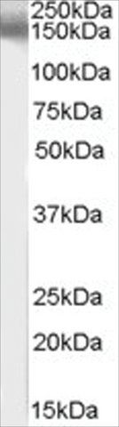 Anti-EPB41L3/DAL1 antibody produced in goat