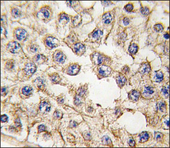 Anti-EPHA10 (center) antibody produced in rabbit