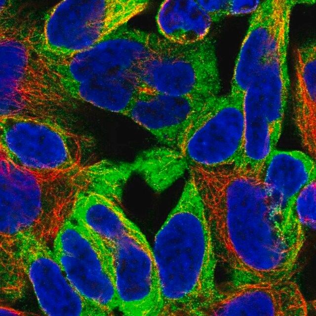 Anti-EPN1 antibody produced in rabbit