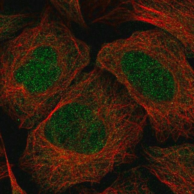 Anti-EPHA6 antibody produced in rabbit