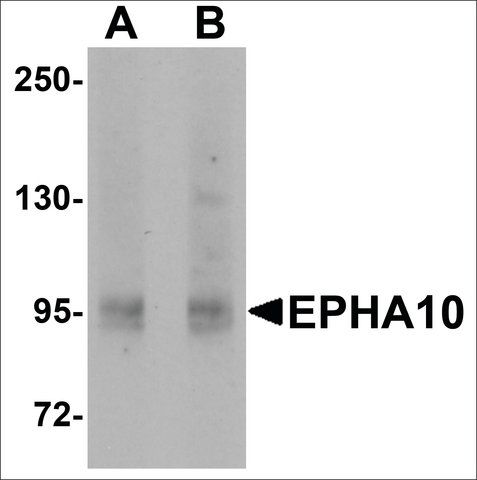 Anti-EPHA10 antibody produced in rabbit