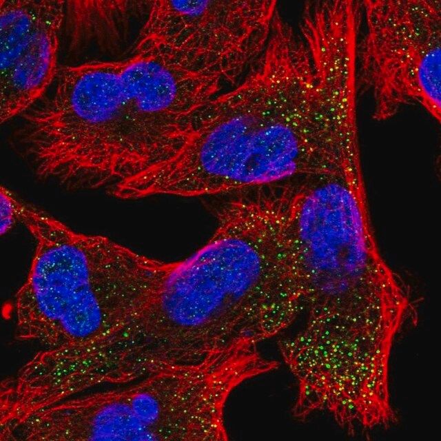 Anti-EPN2 antibody produced in rabbit