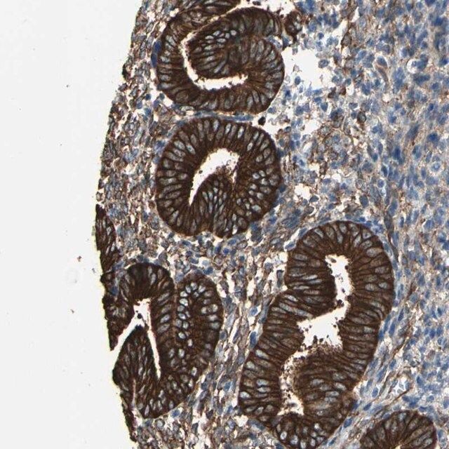 Anti-EPB41L2 antibody produced in rabbit