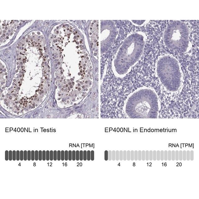 Anti-EP400NL antibody produced in rabbit