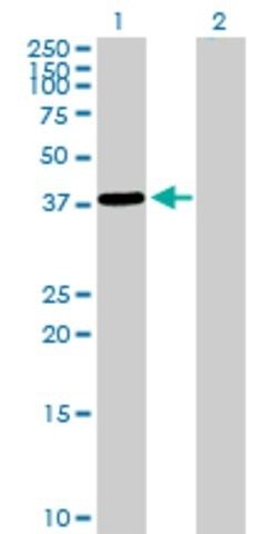 Anti-EPM2A antibody produced in rabbit