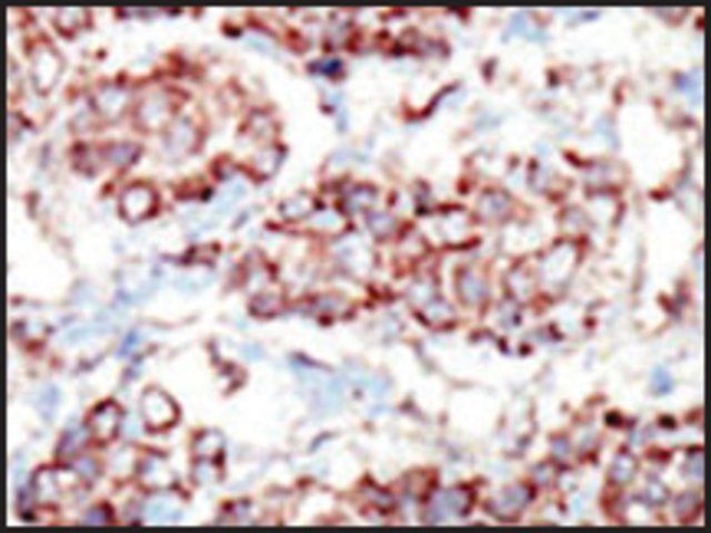 Anti-EphA8 (C-term) antibody produced in rabbit