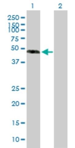 Anti-EFEMP1 antibody produced in mouse