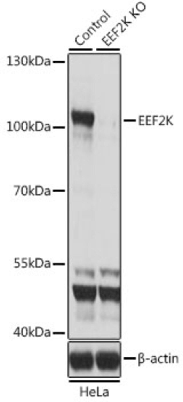 Anti-EEF2K antibody produced in rabbit