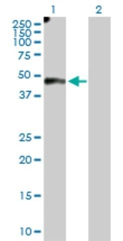 Anti-EFEMP2 antibody produced in rabbit