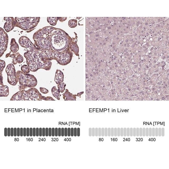 Anti-EFEMP1 antibody produced in rabbit