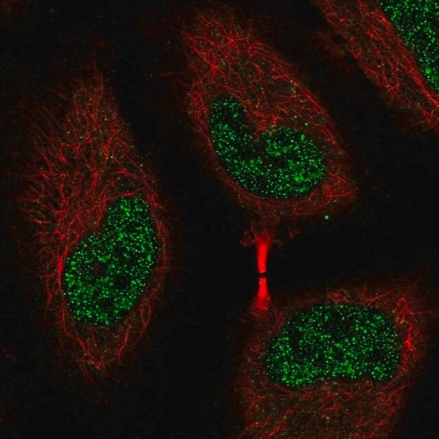 Anti-EEF2K antibody produced in rabbit