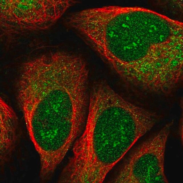 Anti-EEF1D antibody produced in rabbit