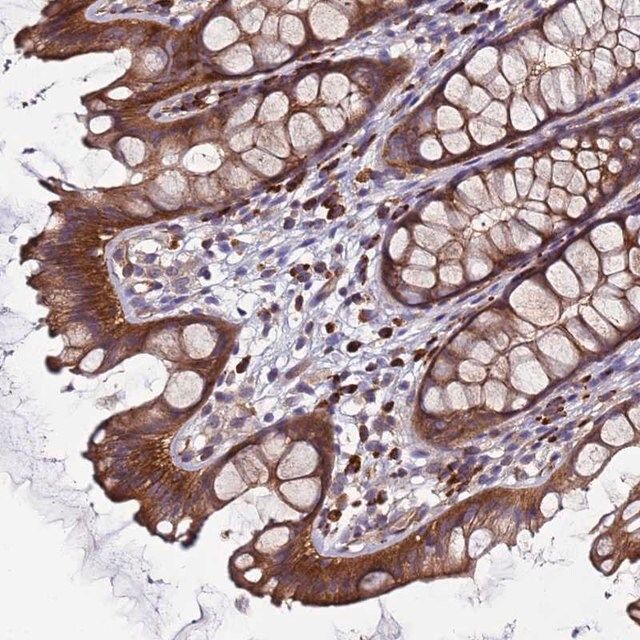 Anti-EFCAB8 antibody produced in rabbit