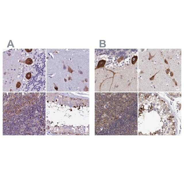 Anti-eEF1G antibody produced in rabbit