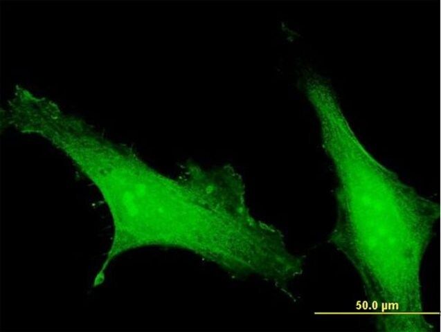 Anti-EFCAB4B antibody produced in mouse