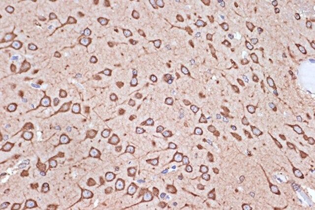 Anti-eEF1G antibody produced in rabbit